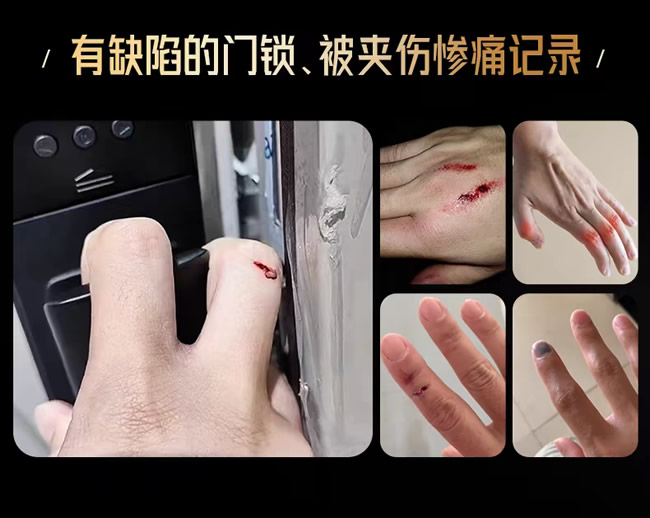王力門業 | 破大防！原來被門夾手是可以不用忍的！